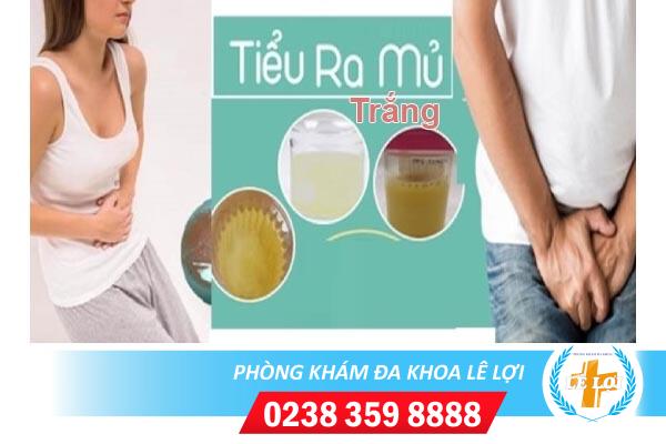 Tiểu ra mủ trắng nguy hiểm không?