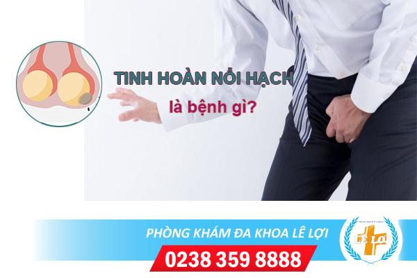 Tinh hoàn nổi hạch là bệnh gì nguy hiểm không?