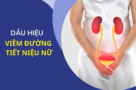 Dấu hiệu viêm đường tiểu ở nữ và cách chữa