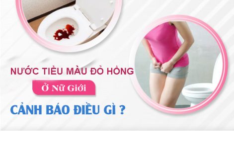 Nước tiểu màu đỏ hồng ở nữ là bị gì?