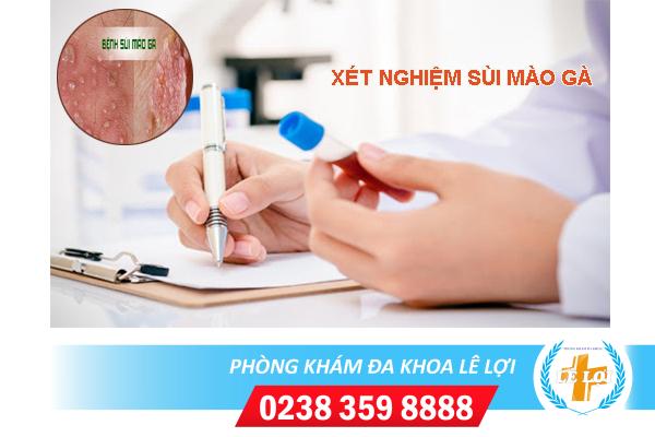 Chi phí xét nghiệm sùi mào gà bao nhiêu?