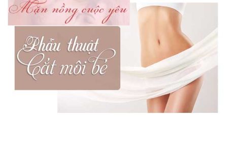 Cắt môi bé tại vinh nghệ an