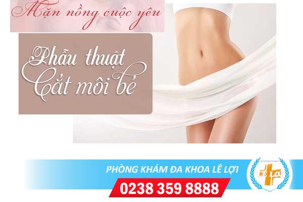 Cắt môi bé tại vinh nghệ an