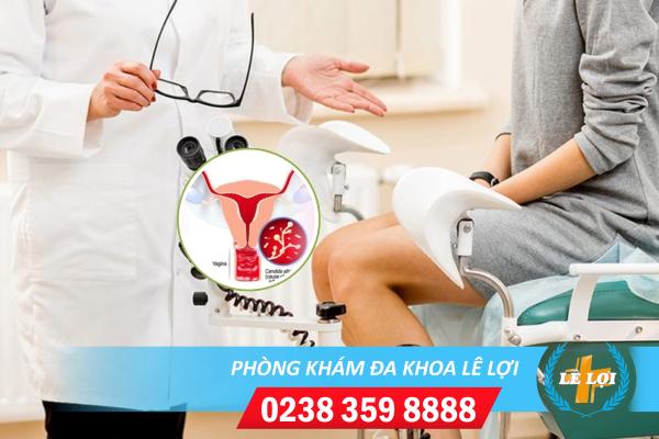 Phương pháp điều trị nấm candida ở nữ giới