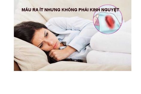 Máu ra ít nhưng không phải kinh nguyệt?