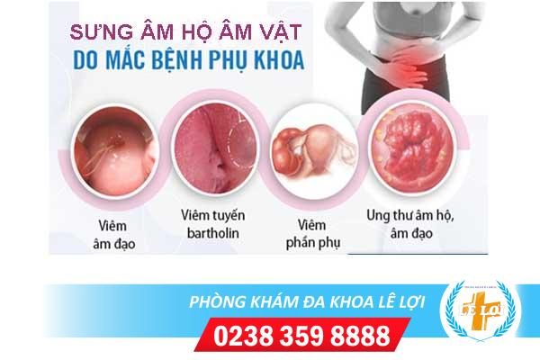 Sưng âm hộ âm vật phải làm sao?