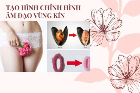 Chi phí tạo hình chỉnh hình âm đạo vùng kín