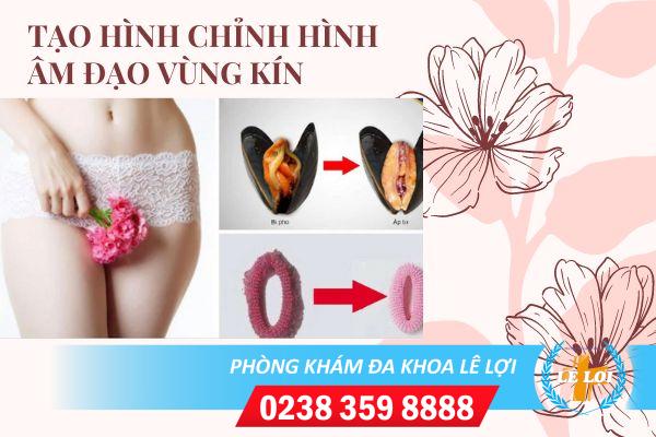 Chi phí tạo hình chỉnh hình âm đạo vùng kín