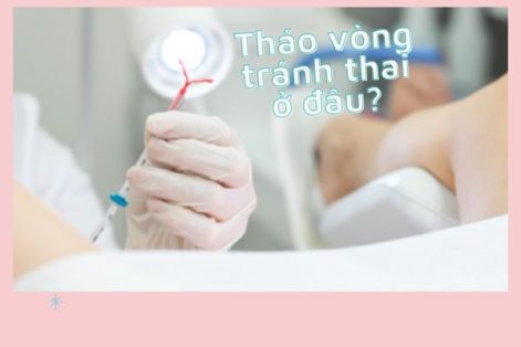 Tháo vòng ở đâu uy tín?