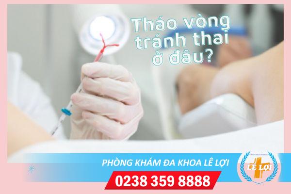 Tháo vòng ở đâu uy tín?