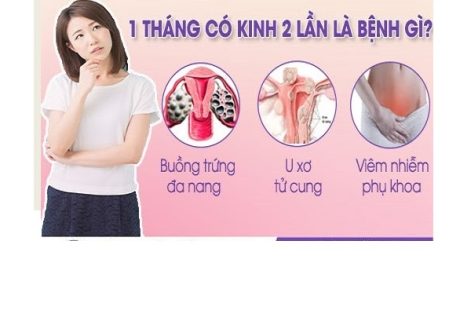 Kinh 2 lần trong 1 tháng là bị bệnh gì?