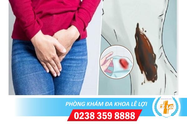 Mới hết kinh ra máu nâu, đen có sao không?