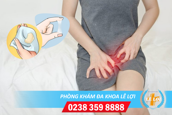 Nguyên nhân dịch âm đạo đặc sệt, dịch âm đạo đặc dính