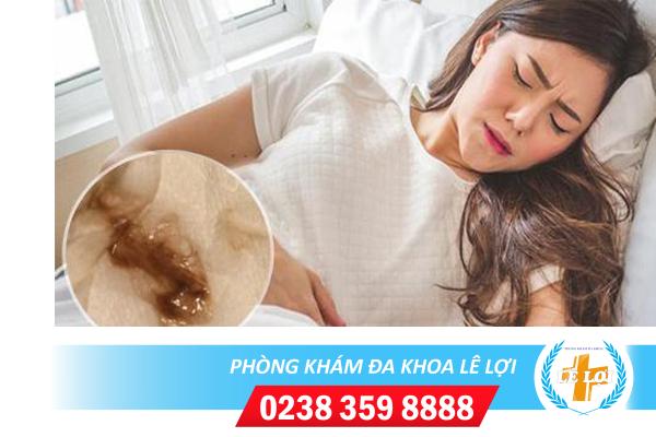 Dịch âm đạo màu đen có phải bệnh lý phụ khoa?