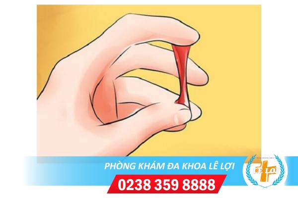 Dịch âm đạo màu đỏ có máu nguy hiểm không?