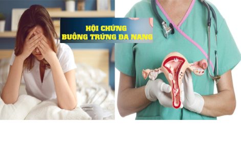 Địa chỉ khám buồng trứng đa nang uy tín