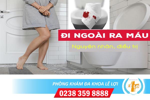 Đi ngoài ra máu là bệnh gì nguy hiểm không?