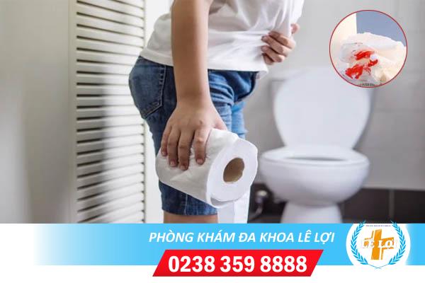 Tại sao đi vệ sinh ra máu và cách điều trị?