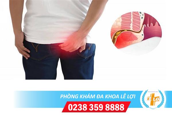 Nóng rát hậu môn là bị bệnh gì?