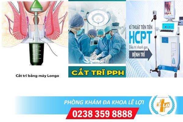 Phương pháp cắt trĩ hiệu quả an toàn