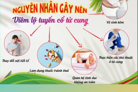 Nguyên nhân gây viêm cổ tử cung bạn cần biết