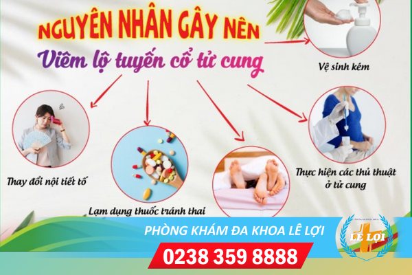 Nguyên nhân gây viêm cổ tử cung bạn cần biết