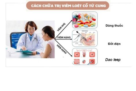 Chữa trị viêm loét cổ tử cung thế nào?