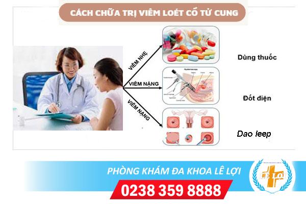 Chữa trị viêm loét cổ tử cung thế nào?