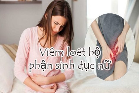 Viêm loét vùng kín nguyên nhân và cách điều trị