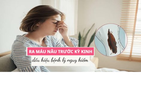 Ra máu nâu trước kỳ kinh nguyệt là bị gì?