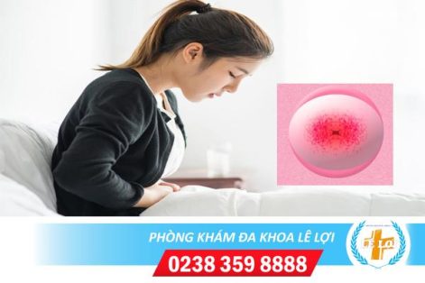 Tổng quan bệnh viêm loét cổ tử cung