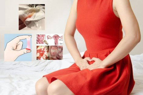 Dịch âm đạo màu hồng là bị bệnh gì nguy hiểm không?