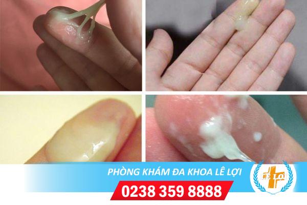 Dịch âm đạo màu trắng có sao không?