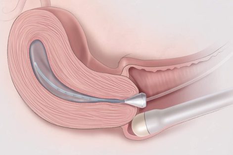 Những điều bạn cần biết về siêu âm phụ khoa đầu dò