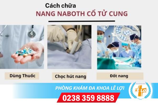 Cách chữa nang naboth cổ tử cung hiệu quả