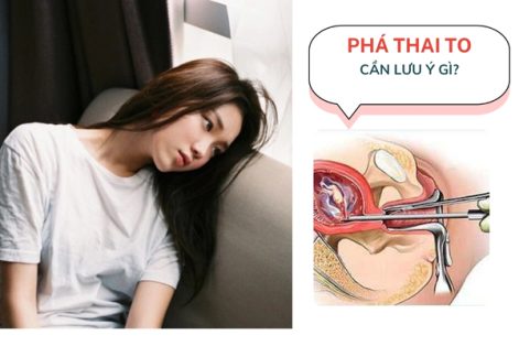 Phá thai to bằng cách nào an toàn?